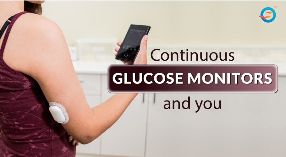 Continuous Glucose Monitors -  Featured image