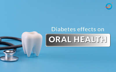 diabetes and oral health, the relationship between oral health and diabetes mellitus, diabetes and oral health an overview, diabetes and oral health articles, diabetes and oral health problems, diabetes mellitus and oral health
