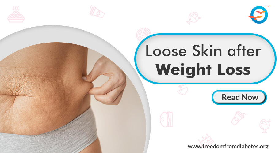 Loose skin after weight loss
