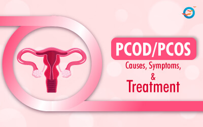 PCOD/PCOS Causes, Symptoms, and Treatment