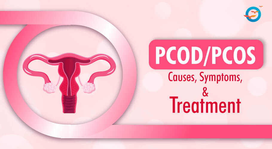 PCOD/PCOS Causes, Symptoms, and Treatment