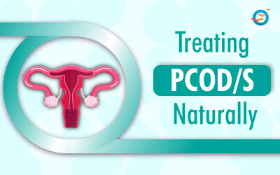 Treating PCOD | PCOS Naturally