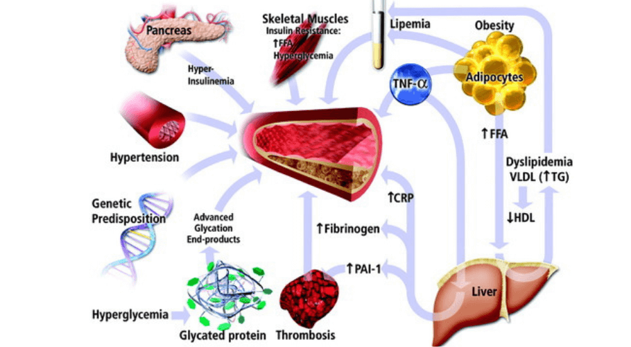 Macrovascular Complications of Diabetes	