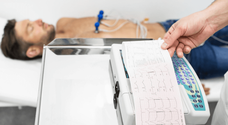 Electrocardiogram (ECG)