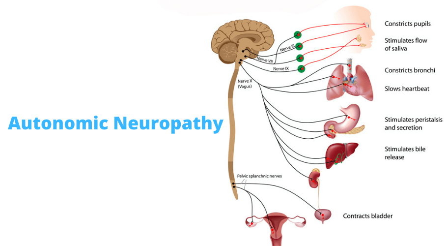 Autonomic Neuropathy